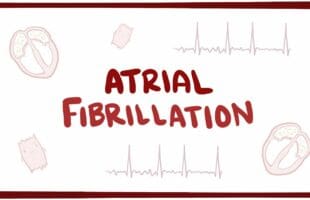 Atrial fibrillation (A-fib, AF) – causes, symptoms, treatment & pathology