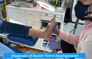Baxter’s nerve entrapment
