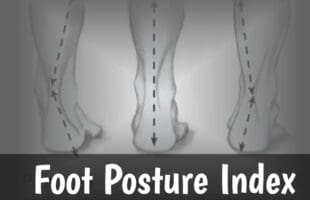 Foot Posture Index