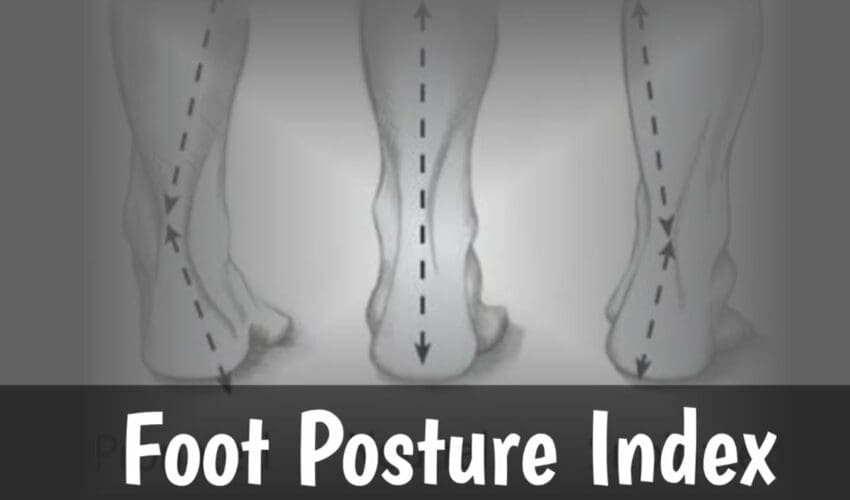 Foot Posture Index